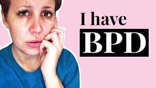 Borderline Personality Disorder - OPENING UP About My Illness